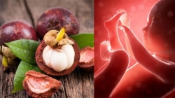 Can pregnant women eat mangosteen?